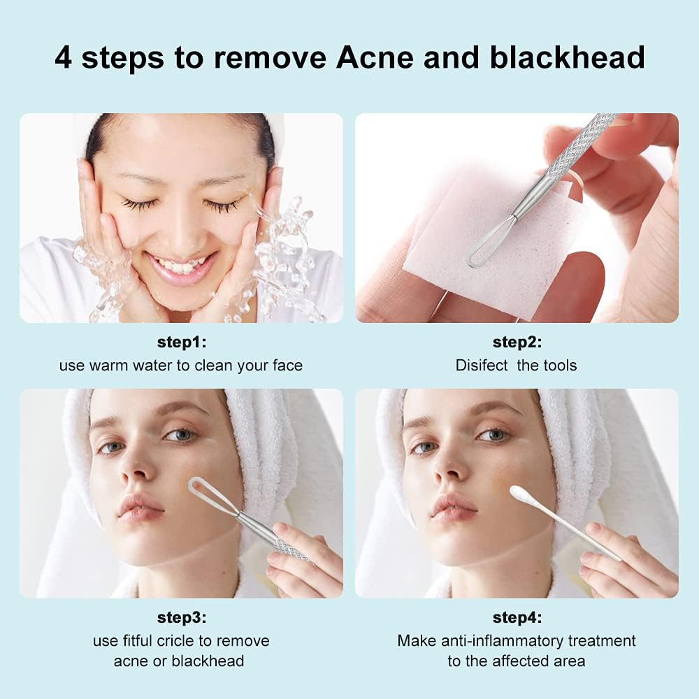 Four steps to remove acne and blackheads using Professional Blackhead Extractor Tool.